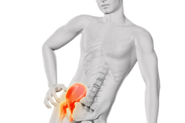 csípőfájdalom - Célzott gerincterápiás kezelés a gondtalan mozgásért!