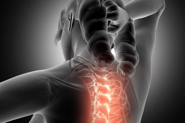 gerincferdülés nyakfájás fájdalom az összes ízület neurológiájában